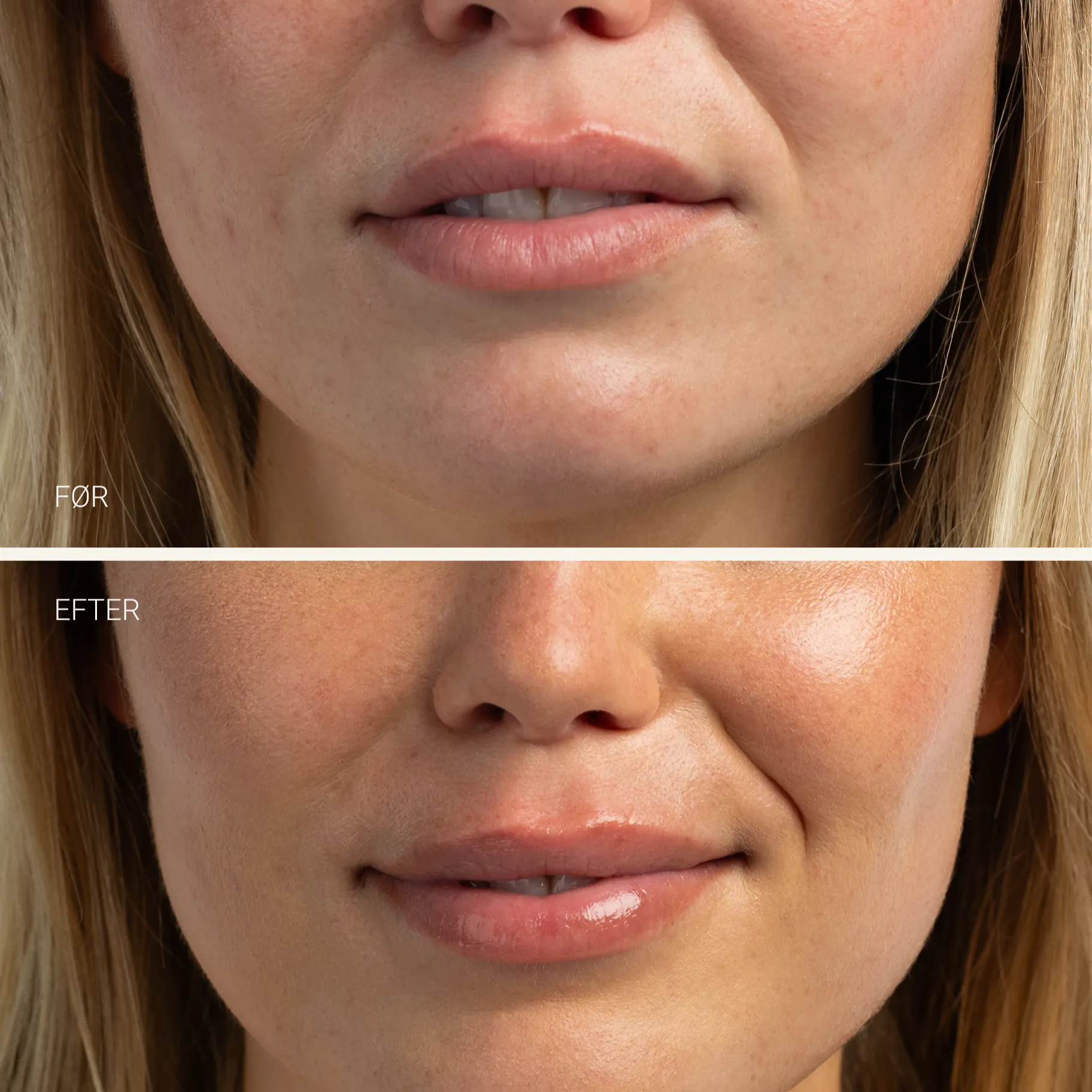LIP BALM HYDRATING