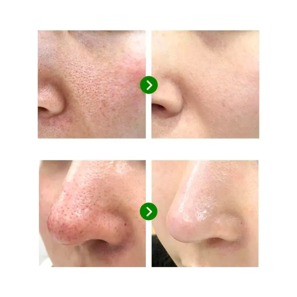 Super Matcha Pore Tightening Serum